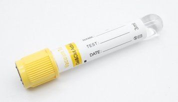 Пробирка с гелем и активатором свертывания, вакуумная желтая 3 мл 80325 фото